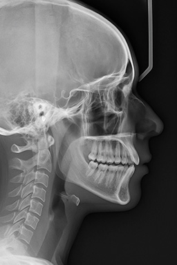telerradiografia