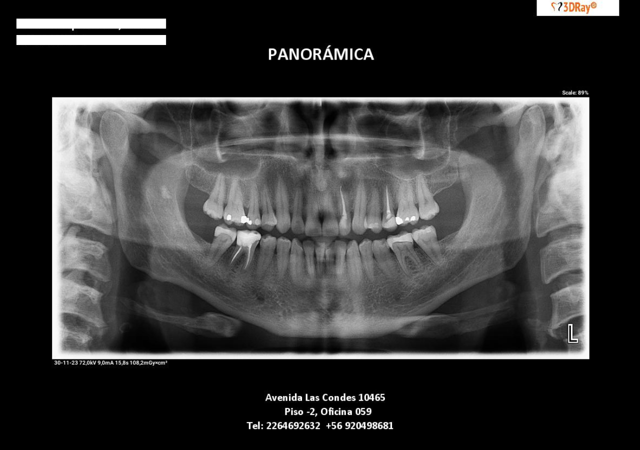 scanner dental 3dray